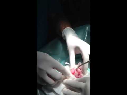 mucina en orina abundante mucina en orina abundante
