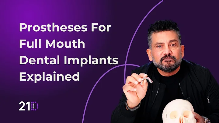 Prostheses For Full Mouth Dental Implants Explained
