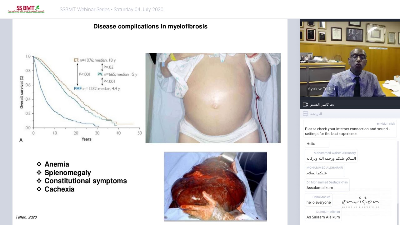 SSBMT Webinar Series How I Treat Primary Myelofibrosis With Prof Ayalew Tefferi 4 July 2020 Ssbmt webinar series how i treat primary myelofibrosis with prof ayalew tefferi 4 july 2020