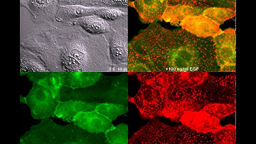 HER2-GFP and EGFR-RFP in SKOV3 cells: endogenous gene tagging by ZFNs