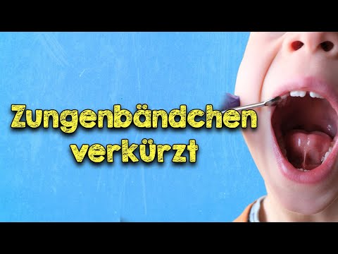 Video: Könnte mein Baby ein Zungenband haben?