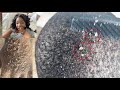 REACTING TO EXTREME DANDRUFF SCRATCHING | Dry Itchy Scalp & Huge Flakes