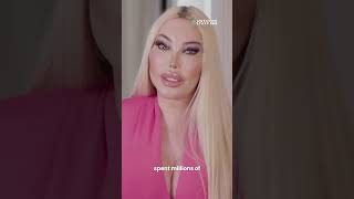 ‘Human Ken Doll’ Spent Millions to Become a Real-Life Barbie