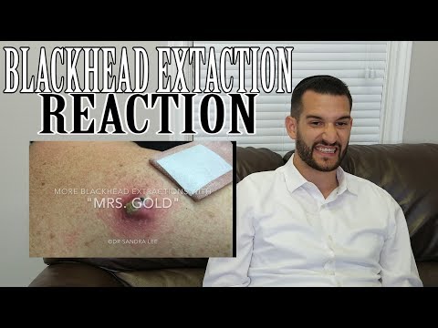Pimple Popping Reaction!