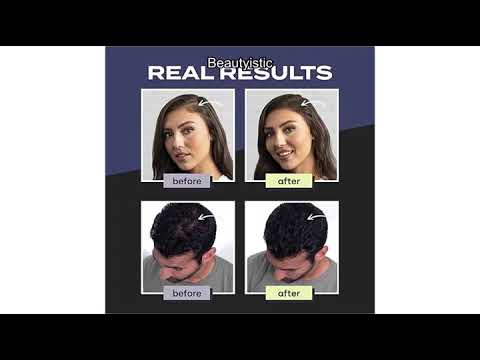 Toppik Hair Building Fibers Review: Thicker, Fuller Hair in Seconds – Is It Worth It?