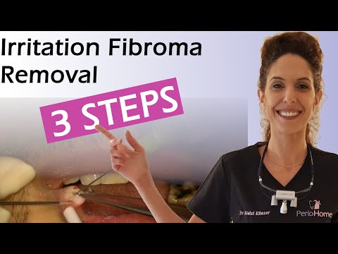 Video: Fibroma Pada Muka - Fibroma Bibir, Fibroma Pada Hidung