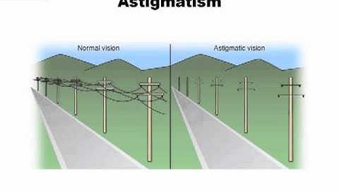 CATS ATPL HPL Astigmatism