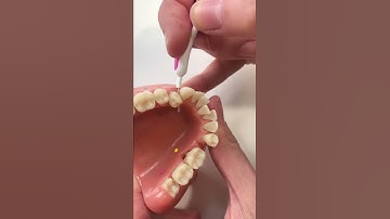 Using an Interdental Brush 2