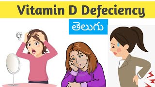 Signs of Vitamin D defeciency||విటమిన్ డి లోపం/Telugu