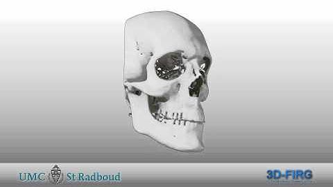 Cone Beam CT 3D-reconstructie