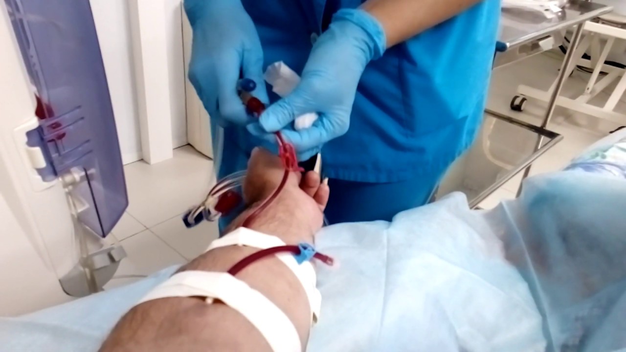 ДИАЛИЗ без прикрас - YouTube