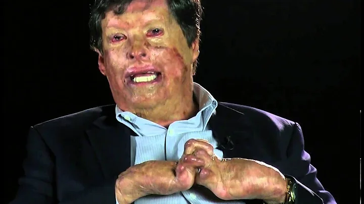 Irwin Sanchez. "Bendigo cada parte de mi cuerpo"