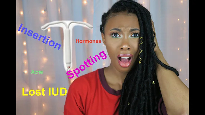 My IUD Experience | Skyla Insertion and 3 Month Up...