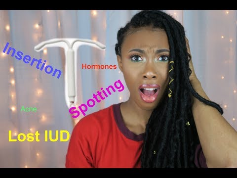 my-iud-experience-|-skyla-insertion-and-3-month-update