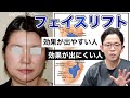 フェイスリフト効果が出やすい人|効果が出にくい人
