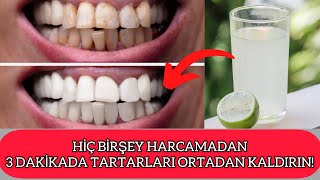 Diş Tartarlarını 3 Dakikada Ortadan Kaldıran Yöntemler