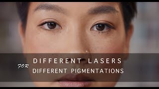 Different Lasers For Different Pigmentation | .