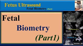 Fetus Ultrasound, Fetal Biometry(Part1)