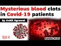 Covid 19 patients getting mysterious BLOOD clotting complication, Current Affairs 2020 #UPSC2020