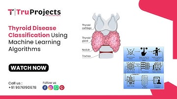 Thyroid Disease Classification Using Machine Learning Algorithms