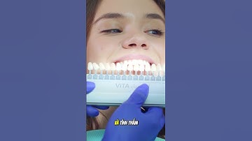 Răng móm nên làm gì? Các giải pháp hiệu quả để cải thiện nụ cười!