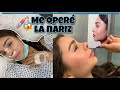 ME OPERE LA NARIZ!!! | I GOT A NOSE JOB IN MEXICO