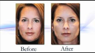Dr. Michael McCracken, Denver - An Introduction to Our Oculoplastic Surgery Practice