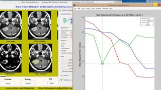 Matlab Project Brain Tumor Detection using Convolutional neural network CNN