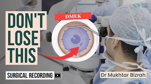 Never Lose Your Ink Mark in DMEK Surgery Again