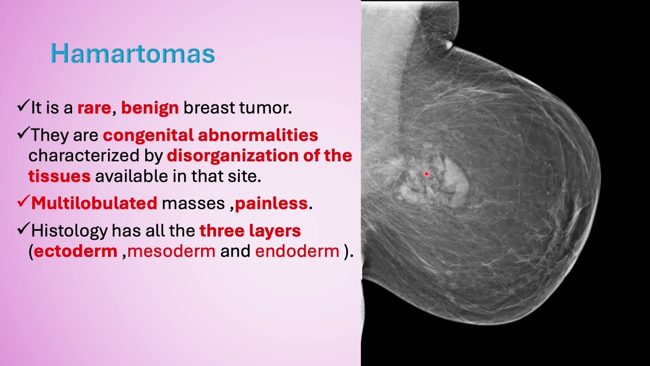 1 Breast conditions  (second part)