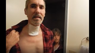 ACDF Surgery Changing the bandage for the first time