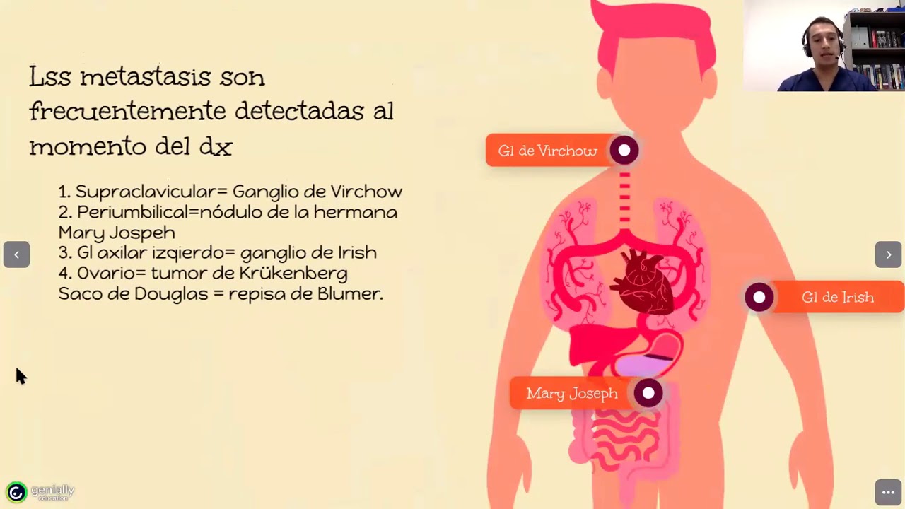 Patología Especial. Generalidades de Cáncer Gástrico y adenocarcinoma.