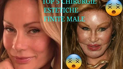 TOP 5 CHIRURGIE ESTETICHE FALLITE