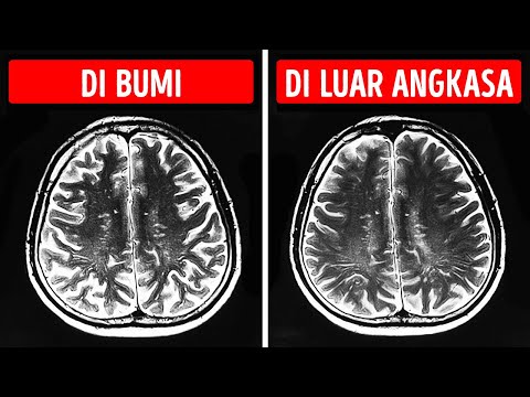 Video: Manusia Adalah Hibrida Alien Dan Primata Karena 90 Organ Ekstra Di Dalam Tubuh - Pandangan Alternatif