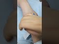 #cannulation #medicalschool #neet #pharmacist #nursingstudent