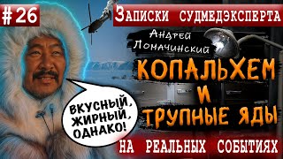 Записки Судмедэксперта | 26. Копальхем И Трупные Яды | Реальные Истории Из Медицинской Практики.