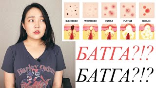 картинка: Батганы 6 төрөл болон эмчилж арилгах орцууд • Anu Harchu