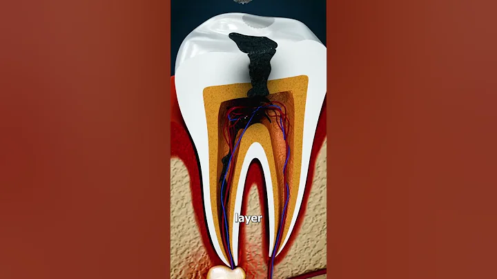 Why Grinding Your Teeth Is Bad 😱 - DayDayNews