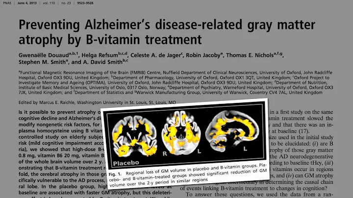 Preventing Brain Loss with B Vitamins?~!