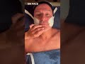 EMFACE ✨ es un tratamiento contra la flacidez facial y las arrugas que está triunfando en toda Europ