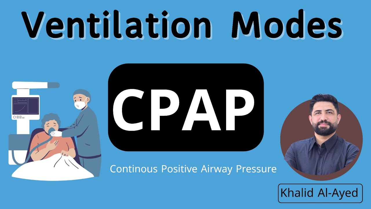Ventilation modes – CPAP