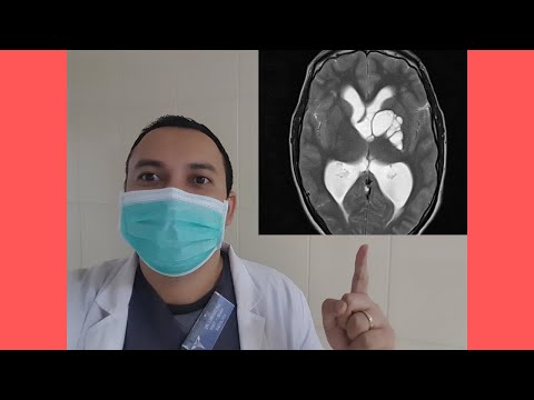 Video: ¿Qué observó virchow?