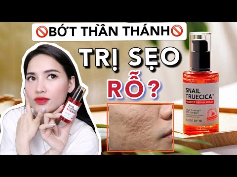 🚫 SỰ THẬT Serum ốc sên đỏ SOME BY MI 🚫| Bớt thần thánh, PR quá đà !!! [GIVE AWAY]