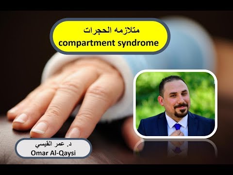 متلازمه الحجرات │ compartment syndrome