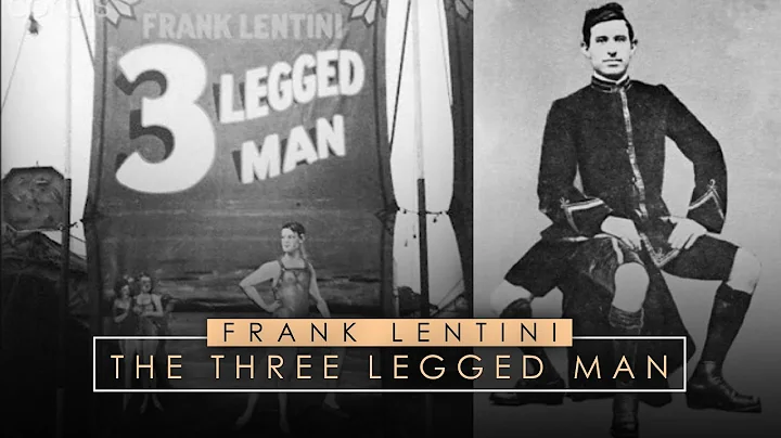 Frank Lentini | The Three Legged Man