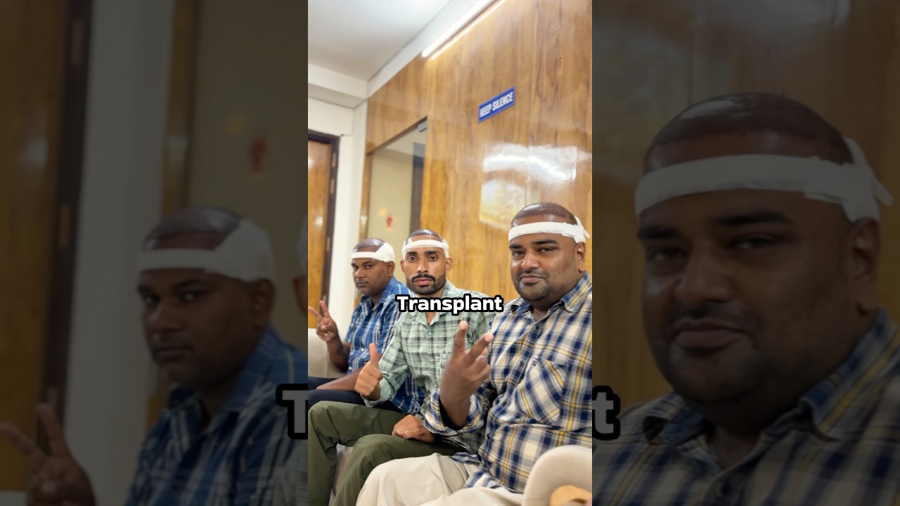 Best Hair Transplant Treatment at Ryan Clinic, Delhi 