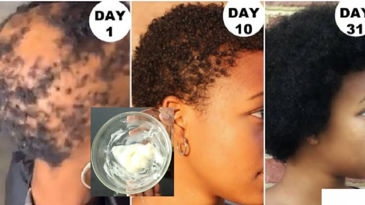 Magical Fast Hair Growth Prevent Split Ends Hair Dandruff YouTube