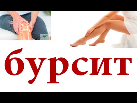 Чем лечить коленный бурсит в домашних условиях