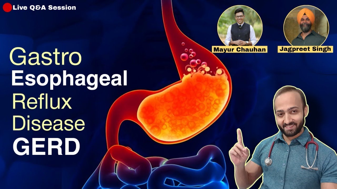 Say GoodBye to Acid Reflux : Discussing ins & outs of GERD | Evaluation & Management of Acid Reflux