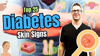 Top 25 Skin Signs & Symptoms of Diabetes [Type 2 Diabetes Early Signs] screenshot 2